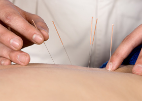 なぜ整体ではなく鍼灸なのか？